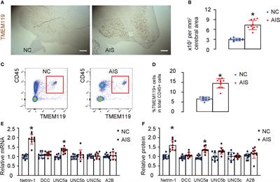 Netrin-1 controls inflammation in response to ischemic stroke through altering microglia phenotype
